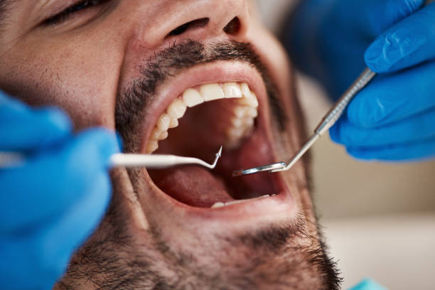 Best Emergency Broken Tooth Repair in Rio Dell, CA